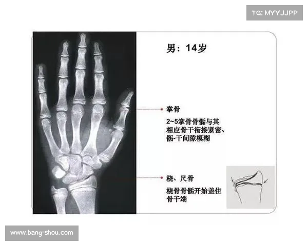 中国青少年联赛严打年龄造假骨龄检测不合格者禁赛三年 中国青少年联赛严打年龄造假骨龄检测不合格者禁赛三年